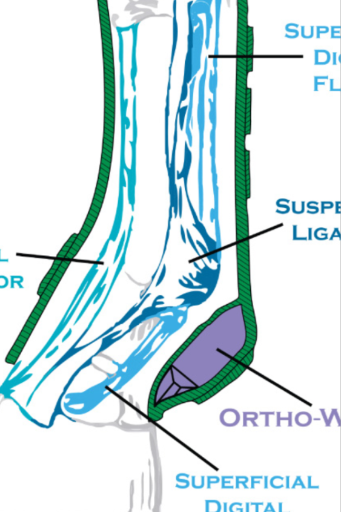 Iconoclast® Rehabilitation boot